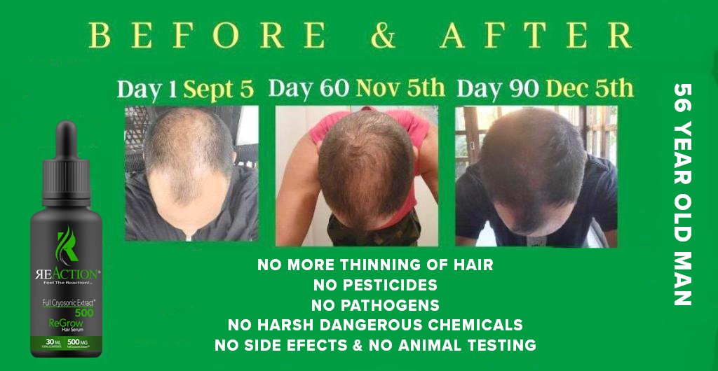 ReGrow Hair Grow